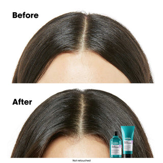 L'Oréal Professionnel Scalp Advanced Anti-Discomfort Treatment 200 ml