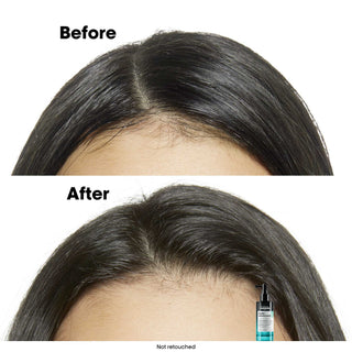 L'Oréal Professionnel Scalp Advanced Anti-Oiliness Shampoo 300 ml