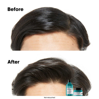 L'Oréal Professionnel Scalp Advanced Anti-Oiliness Shampoo 300 ml