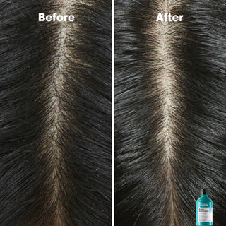 L'Oréal Professionnel Scalp Advanced Dermo-Clarifier Shampoo 300 ml