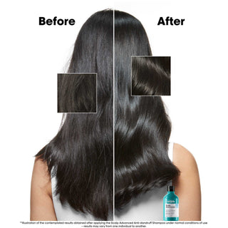 L'Oréal Professionnel Scalp Advanced Dermo-Clarifier Shampoo 300 ml